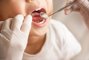 Dentists Examination of Childs Mouth
